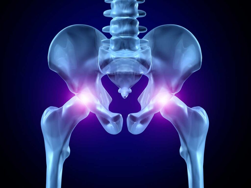 yaslilarda kalca kirigi 1