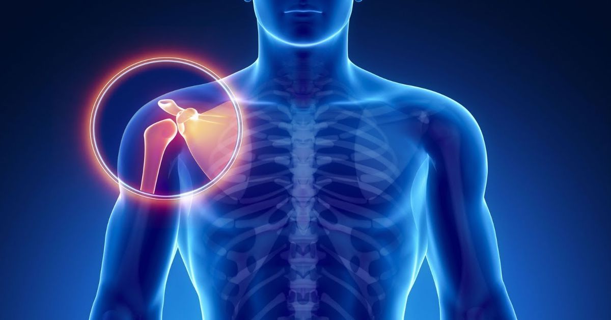 Eklem Çıkığı 7 Eklem Çıkığı