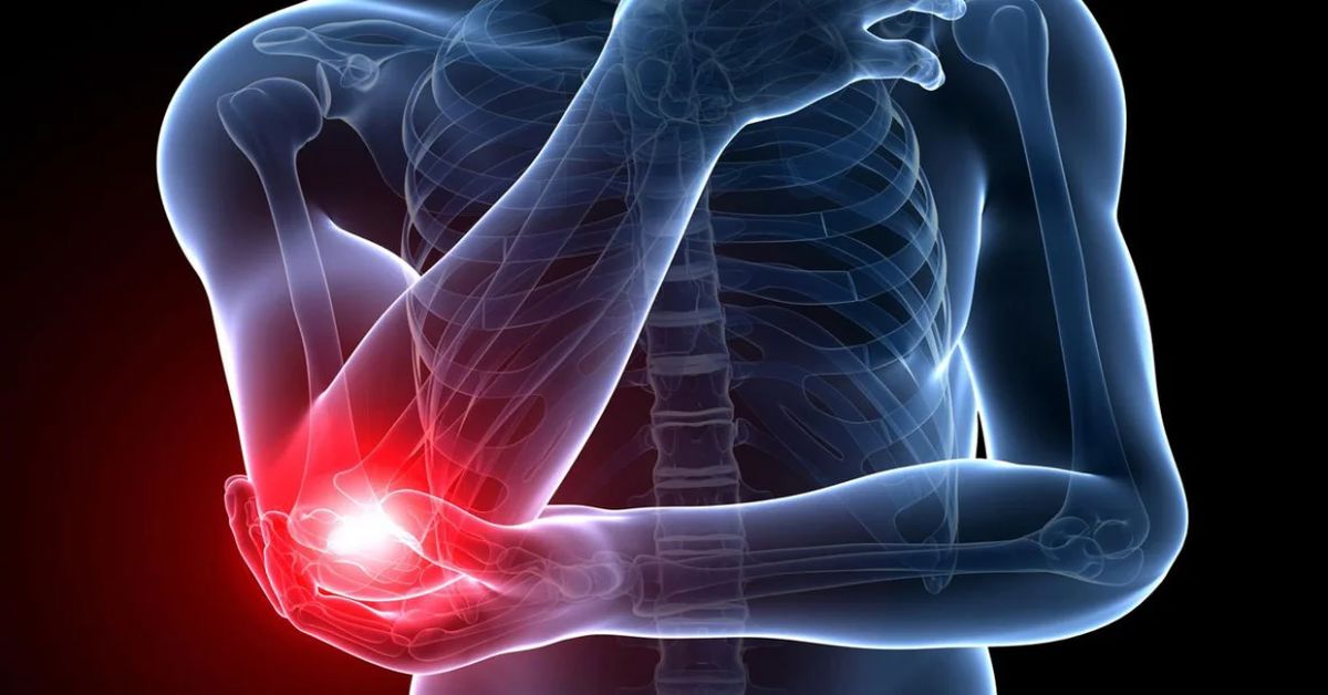 Eklem İltihabı 9 Eklem İltihabı