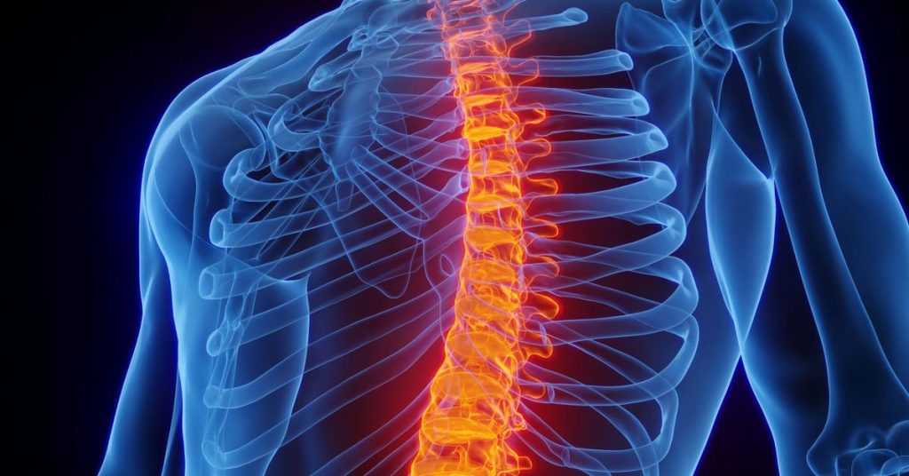 Omurga Kırığı 3 Omurga Kırığı