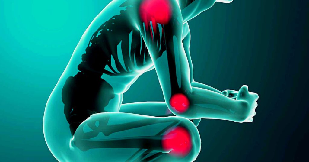 Kırık Ameliyatı Sonrası