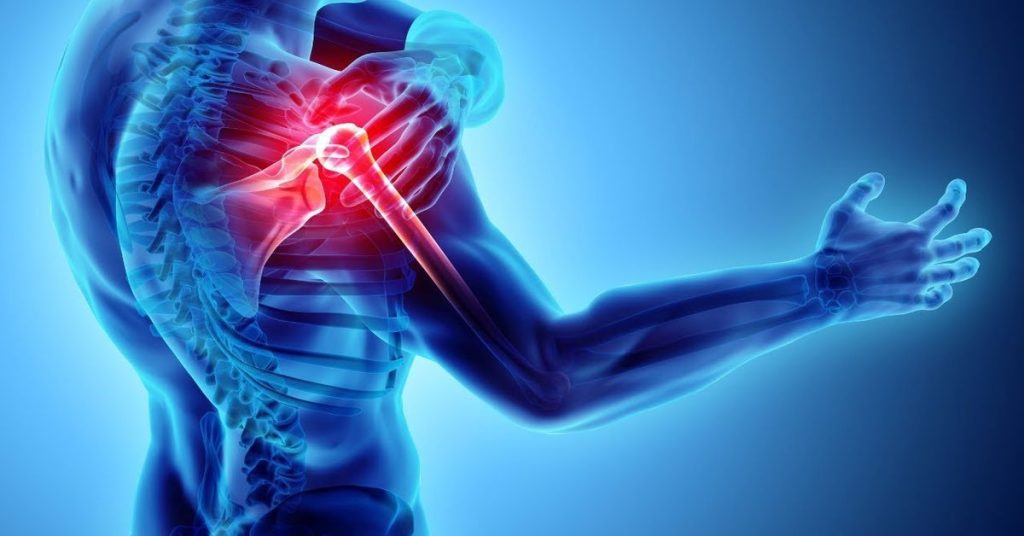 Donuk Omuz Tedavisi 2 Donuk Omuz Tedavisi