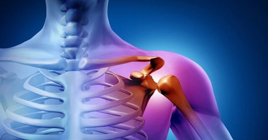 Eklem Çıkığı Tedavisi 2 Eklem Çıkığı Tedavisi