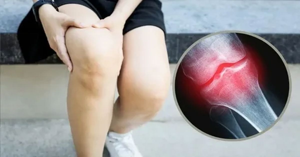 Avasküler Nekroz Ameliyatı